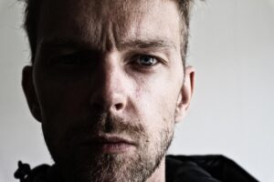 頬のシミを目立たなくする方法にはどんなものがある？