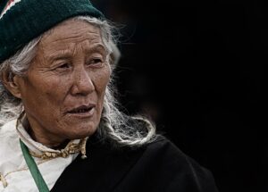 額のシワを改善するための効果的な方法は？