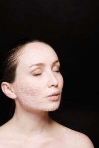 スキンケアにおけるピーリングの正しい順番は？