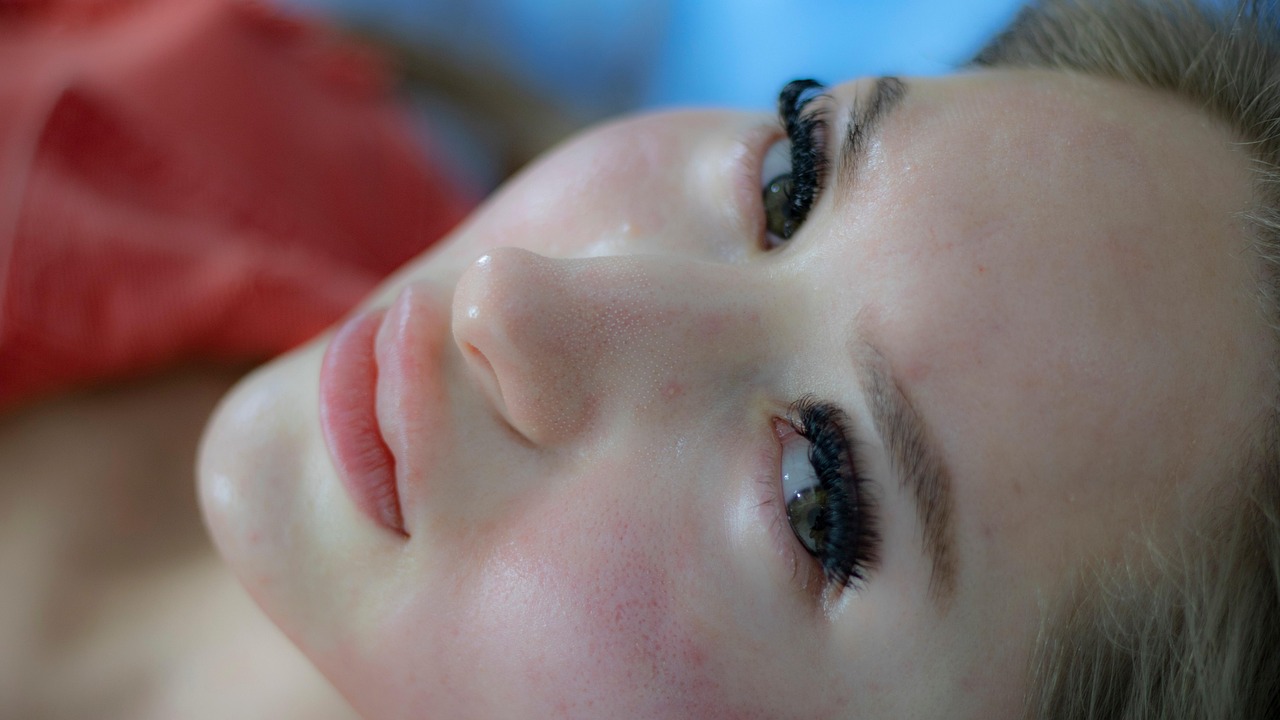 スキンケアをしすぎるとニキビができる理由とは？