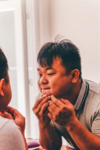 敏感肌の人がニキビ対策に最適な化粧品の選び方は？